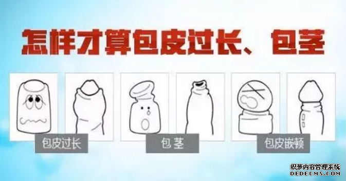 赤峰包皮过长还分“真假”“假的”就不用割吗?