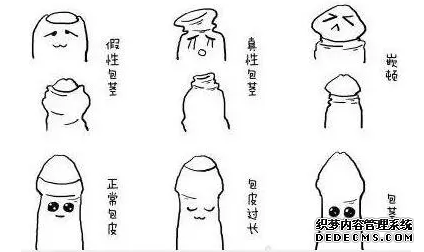 宝鸡自己属于包皮包茎哪类型呢？赶紧看看吧！