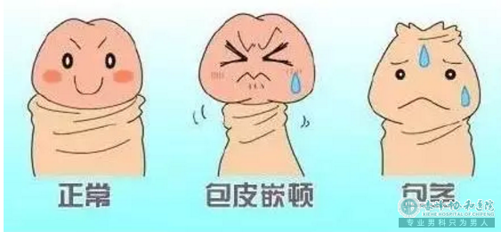 宝鸡松山区做包皮手术男科医院电话 宝鸡松山区做包皮手术男科医院电话
